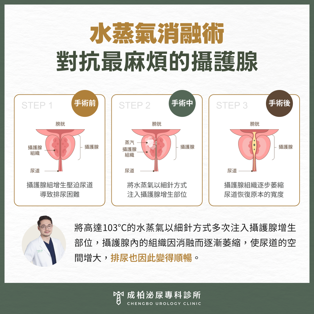 水蒸氣消融術，對抗最麻煩的攝護腺