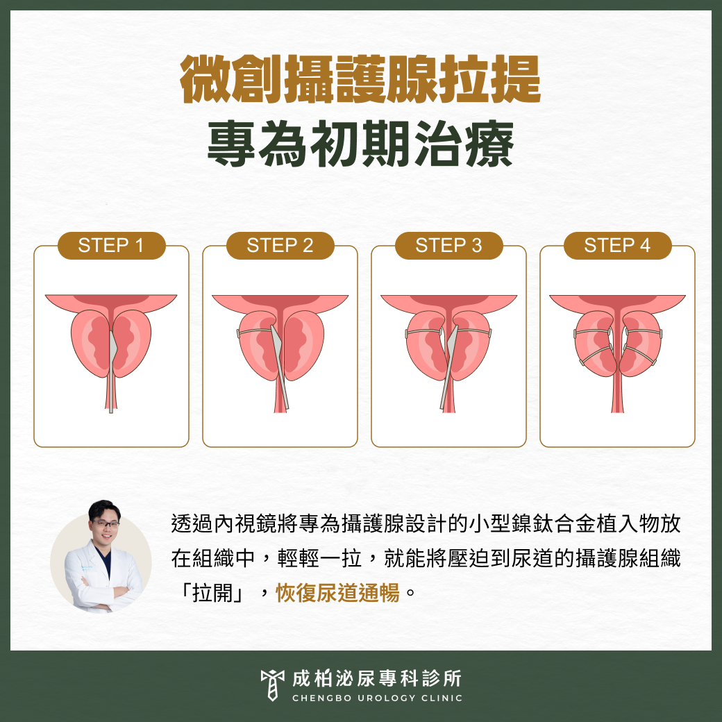 微創攝護腺拉提，專為初期治療