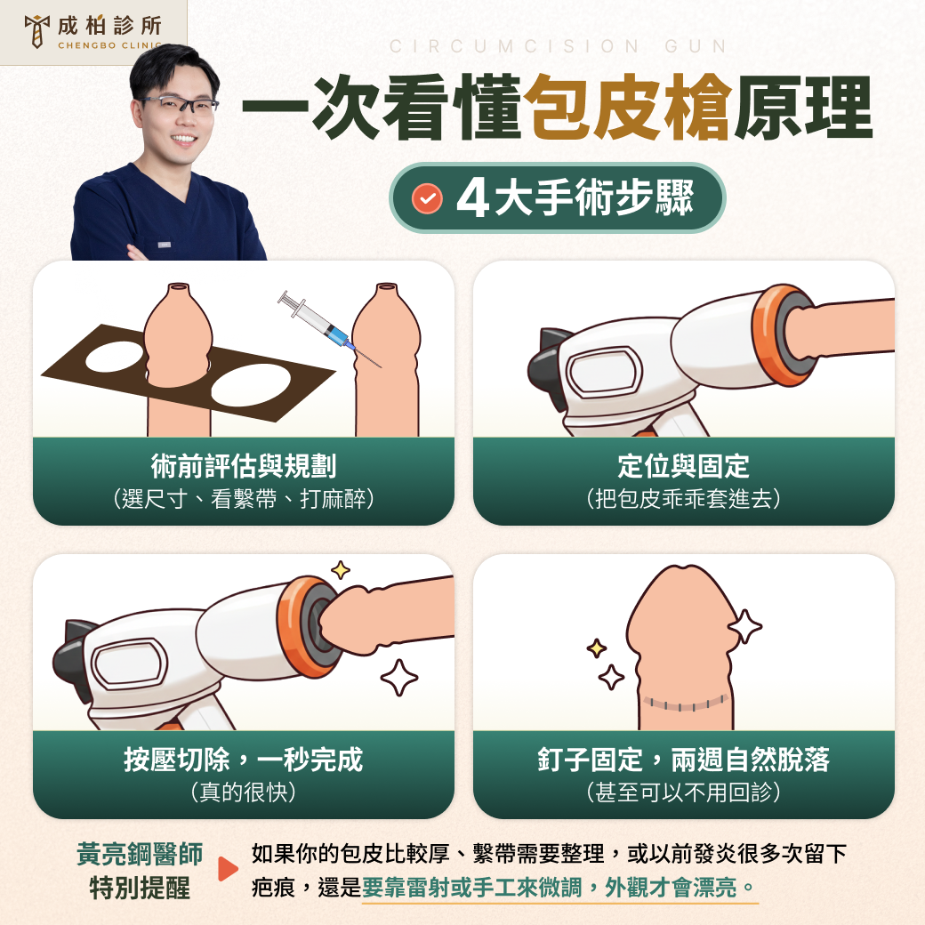 包皮槍的原理步驟與適合族群