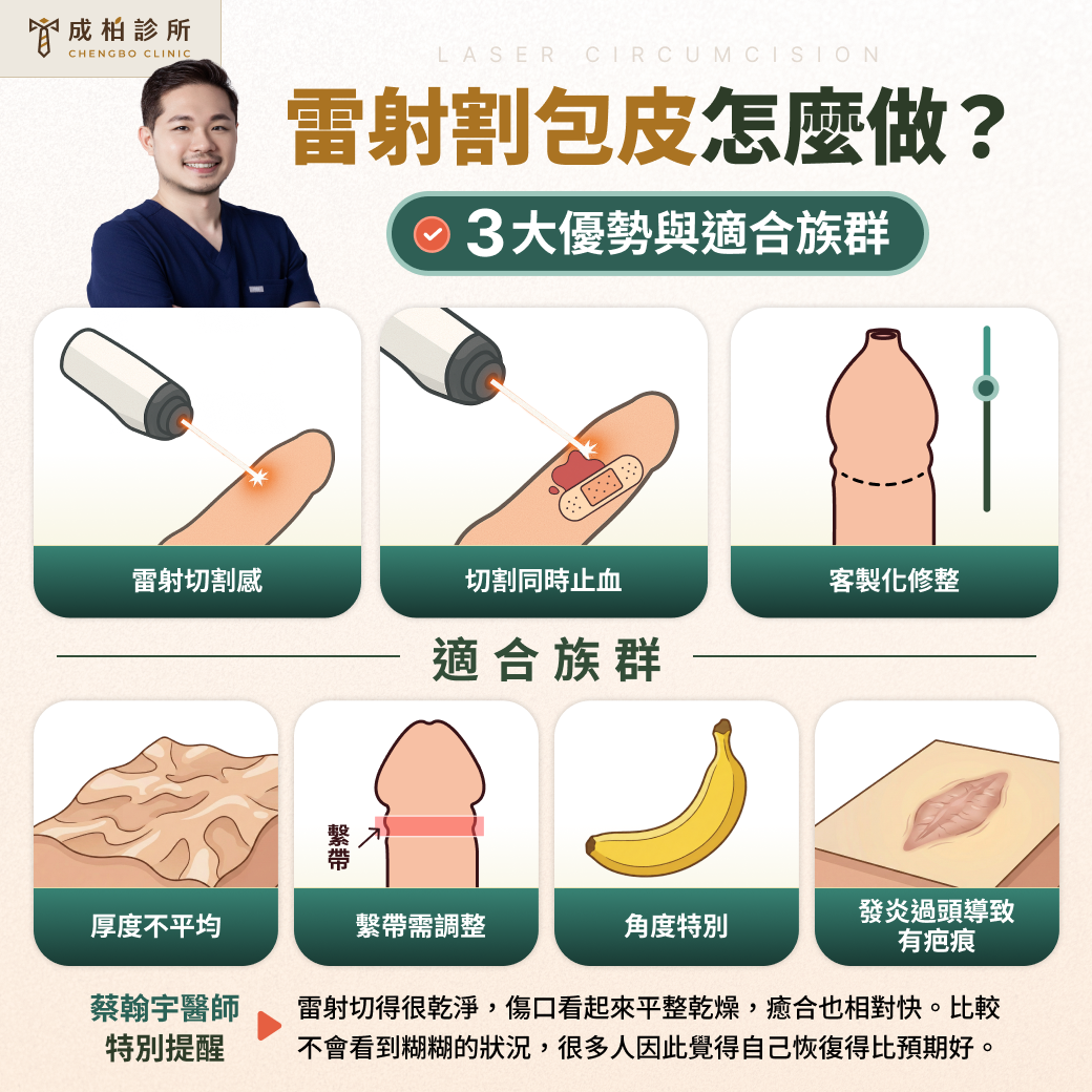 雷射割包皮的原理與適合族群
