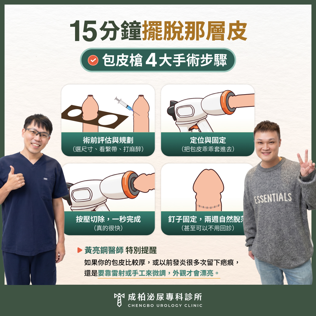 包皮槍手術讓我15分鐘就擺脫那層皮！